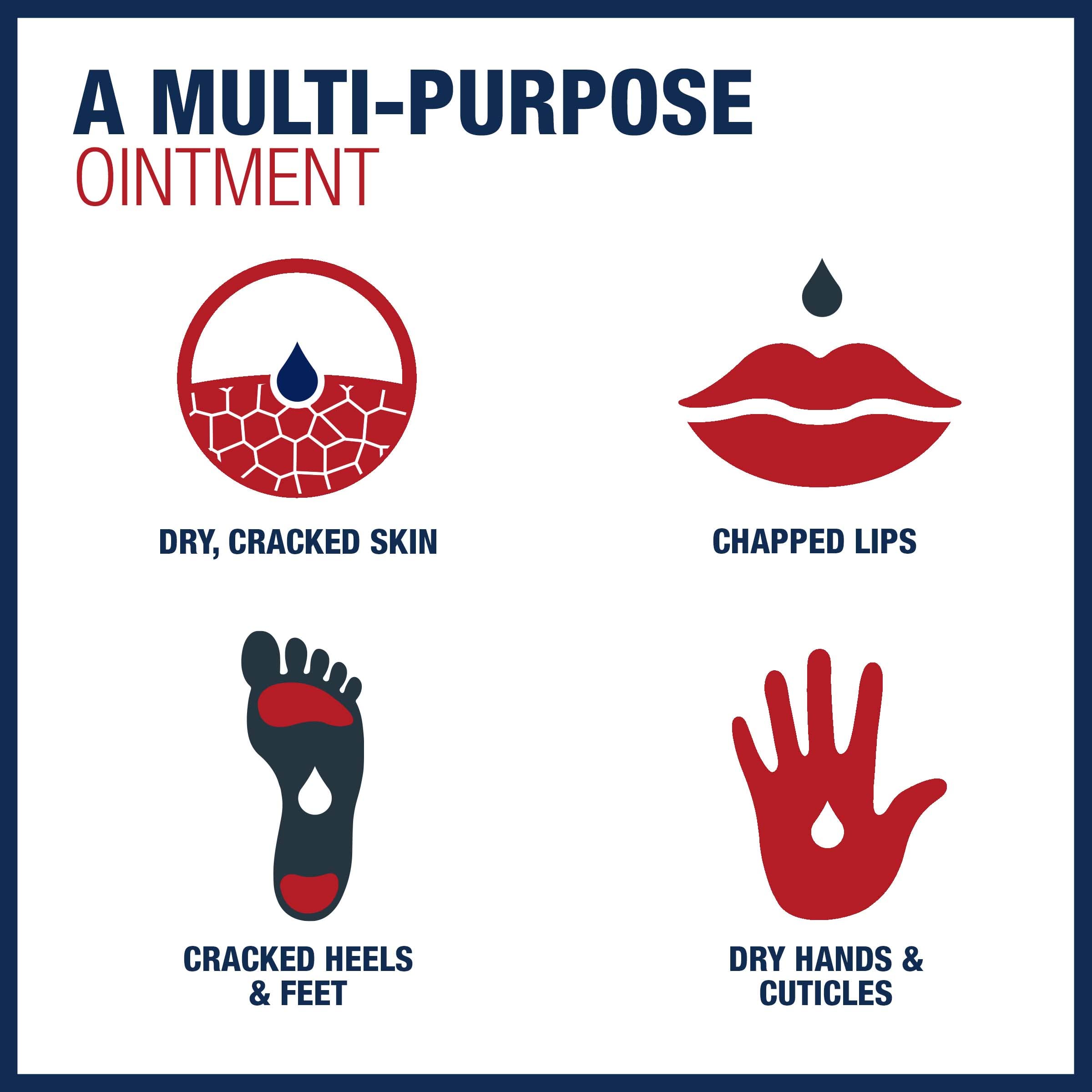 Aquaphor Healing ointment, skin protection, 14oz weight